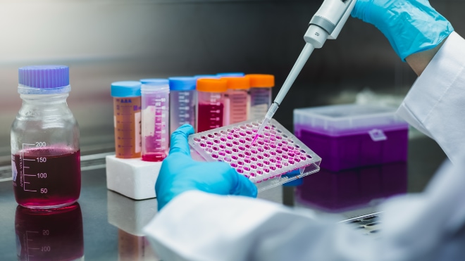 A scientist uses a pipette to prepare lab samples.